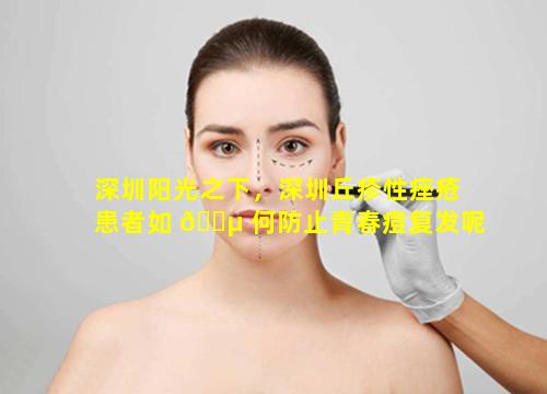 深圳阳光之下，深圳丘疹性痤疮患者如 🌵 何防止青春痘复发呢